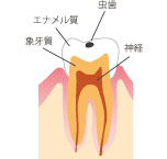 C1